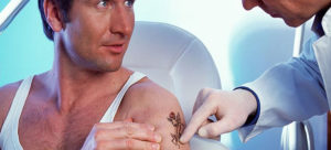 Tattoos mit Laser entfernen