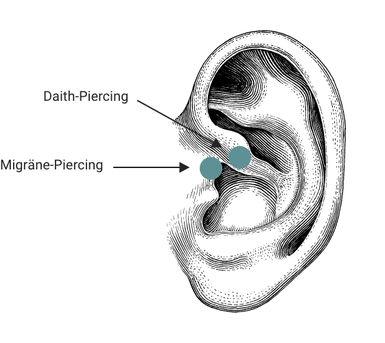 Migräne-Piercing vs. Daith-Piercing